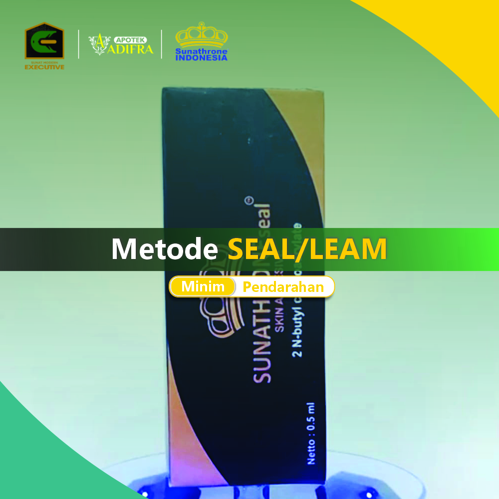 Feed Metode SEAL